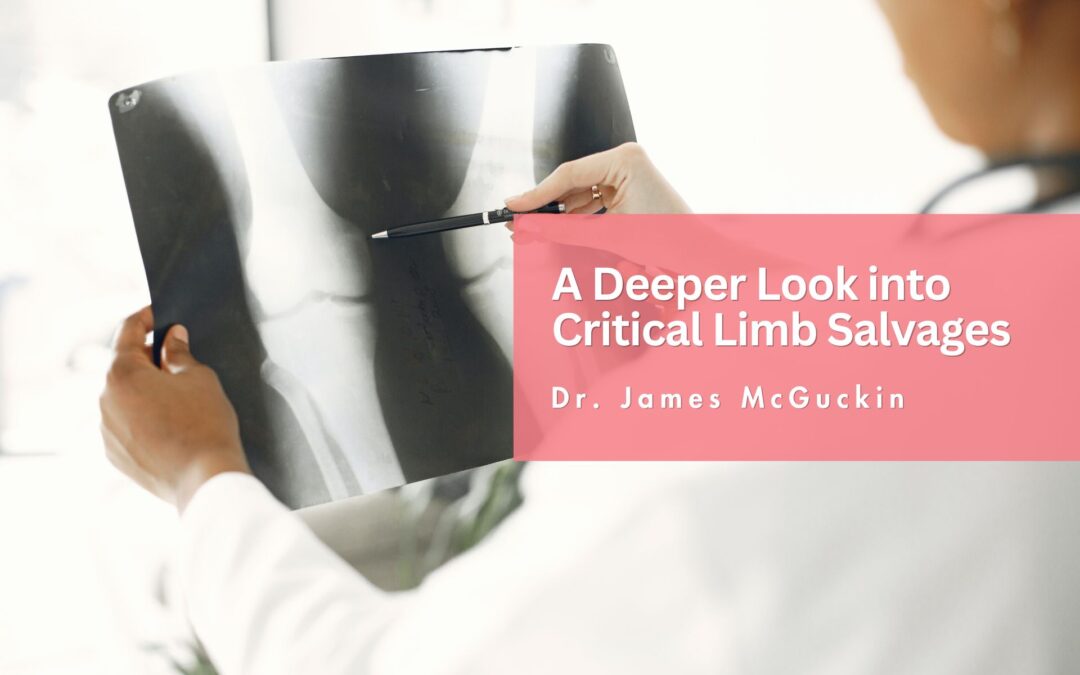 A Deeper Look into Critical Limb Salvages